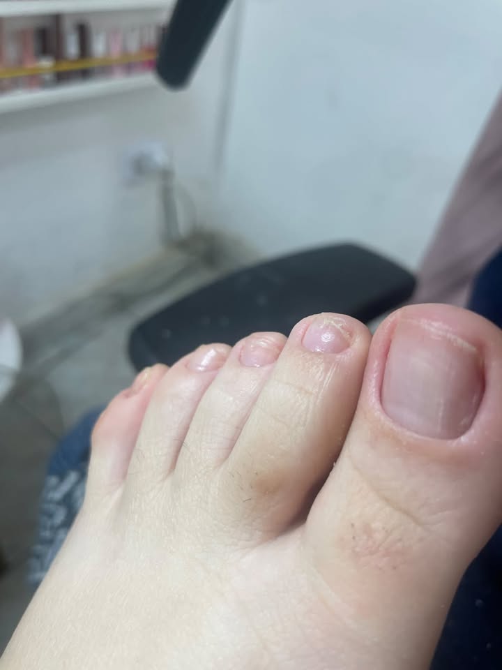Pedicure — trabalho de Eliane Brombini, foto 4