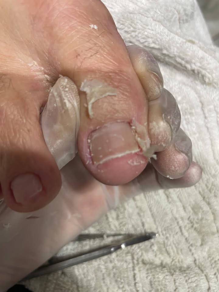 Podologia — trabalho de Eliane Brombini, foto 1