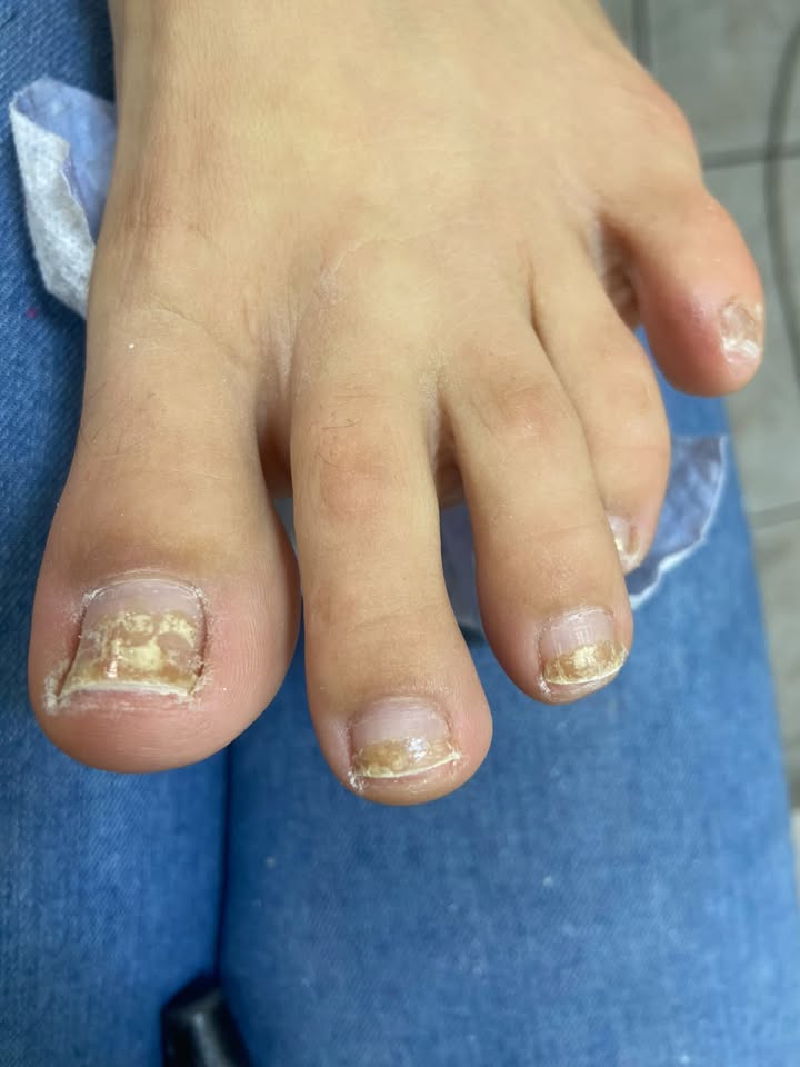 Pedicure — trabalho de Eliane Brombini, foto 3