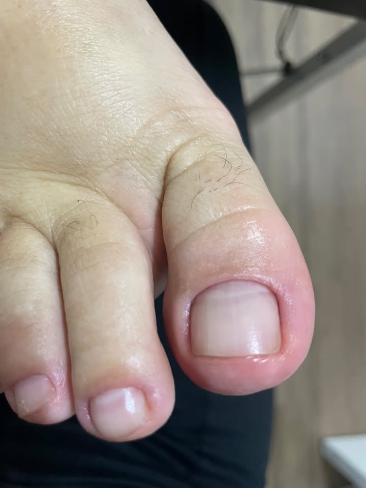 Pedicure — trabalho de Eliane Brombini, foto 1